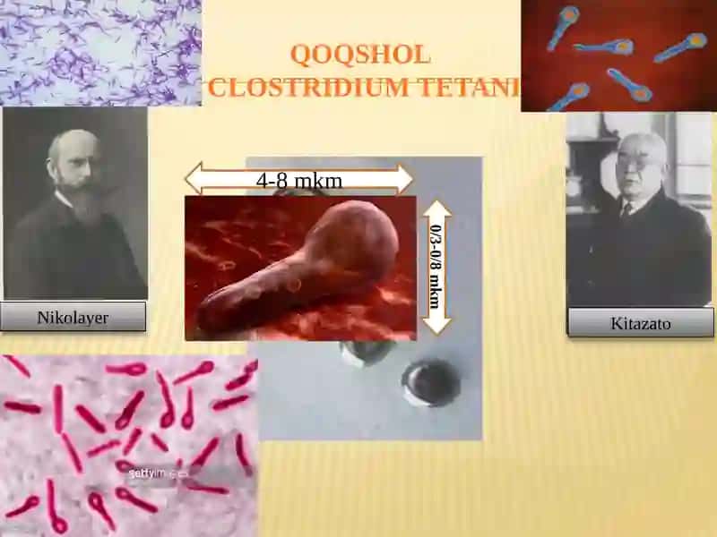 Gazligangrena qoʼzg'atuvchilari tashxisi 4