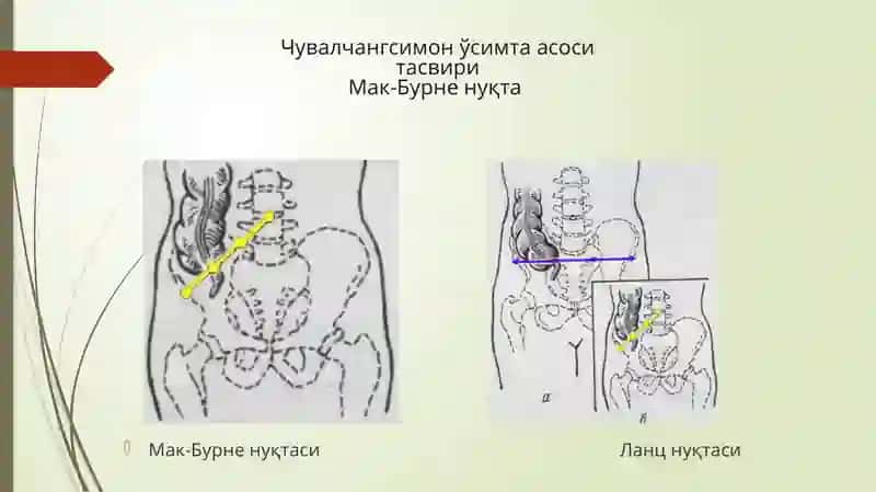 Қоринолд-ёндеворининг жарроҳлик анатомияси 4