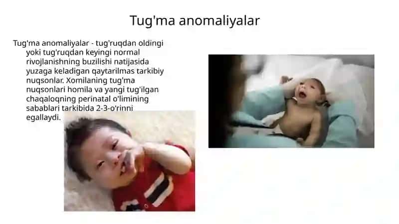 BOLALAR XIRURGIYASI 4