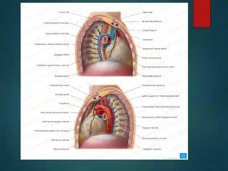 MEDIASTENIT 4