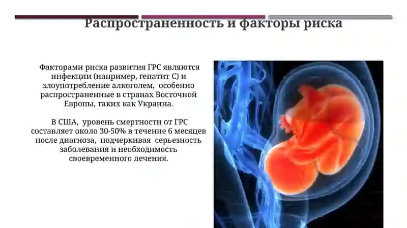 Диагностика и лечение гепаторенального синдрома 4