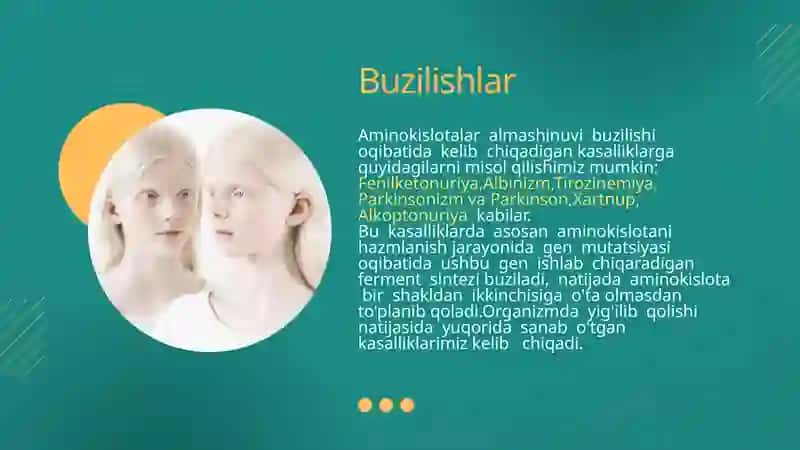 Aminokislotalar almashinuvining tug'ma kasalliklari 4