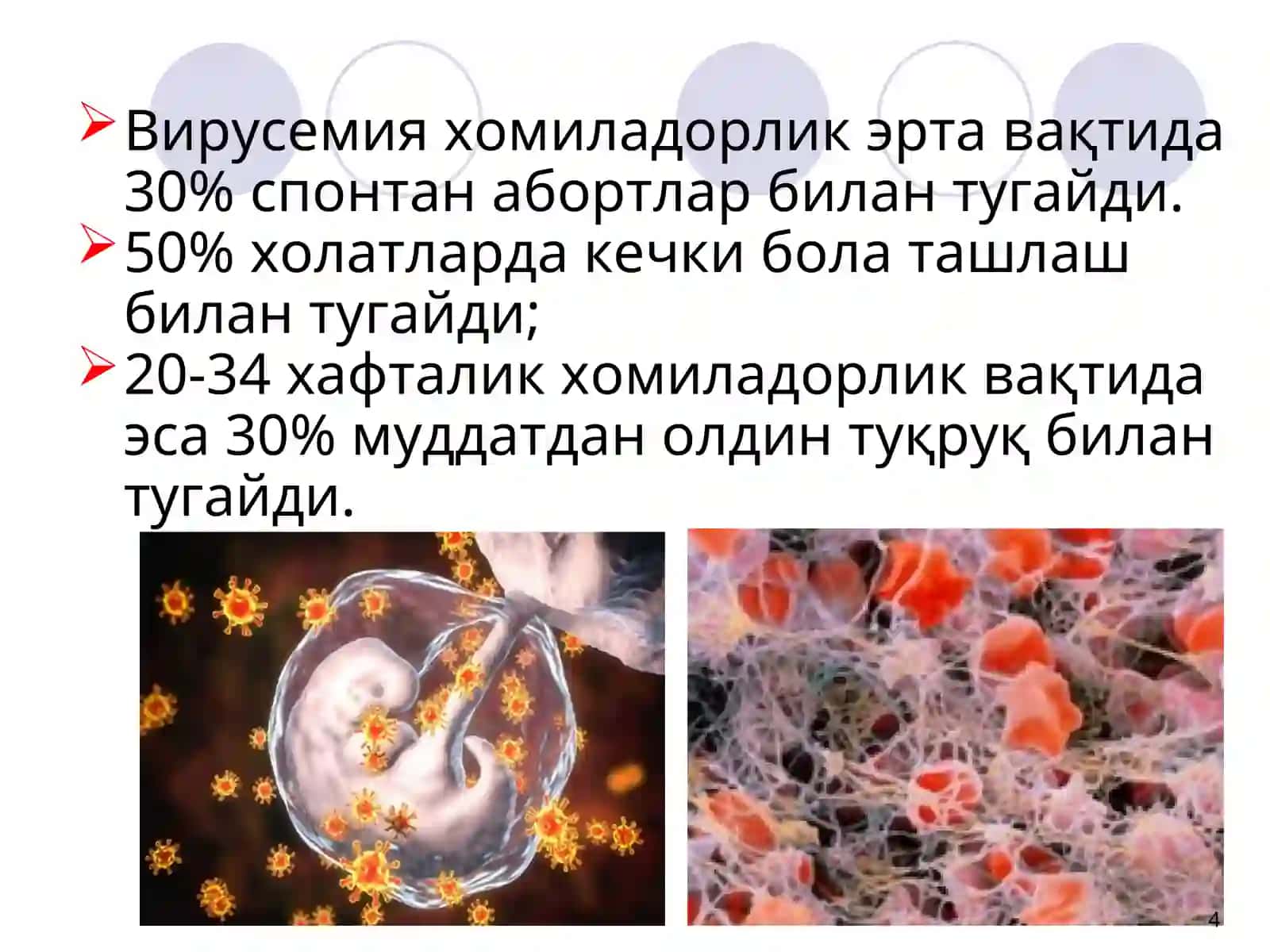 Чақалоқларда хомила ичи инфекциялари 4