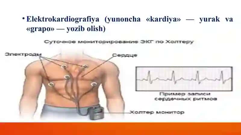 EKG 4