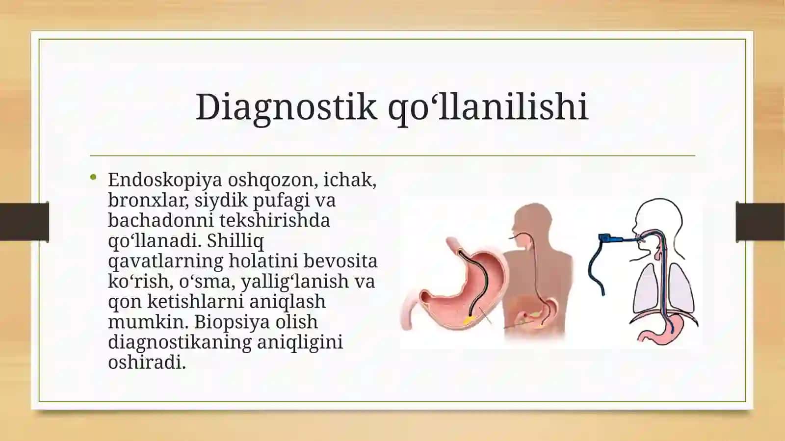 Tibbiyotda endoskopik usullarning qoʻllanishi 4