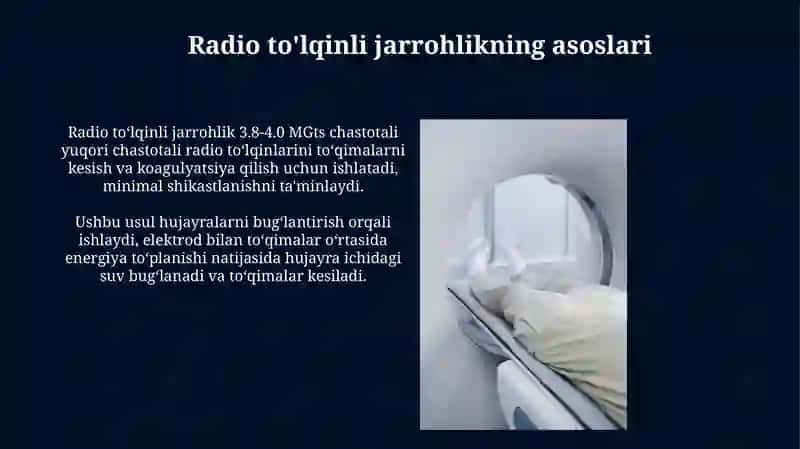 Radio to'lqinli jarrohlik 4