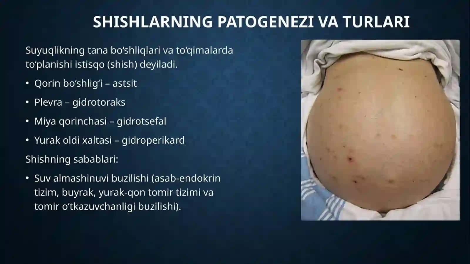 Gemodinamik Buzilishlar Patofiziologiya 4