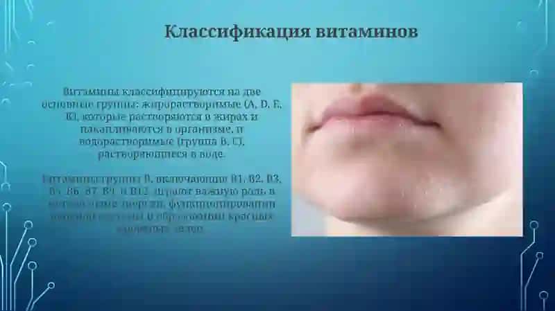 Авитаминоз и гиповитаминоз 4
