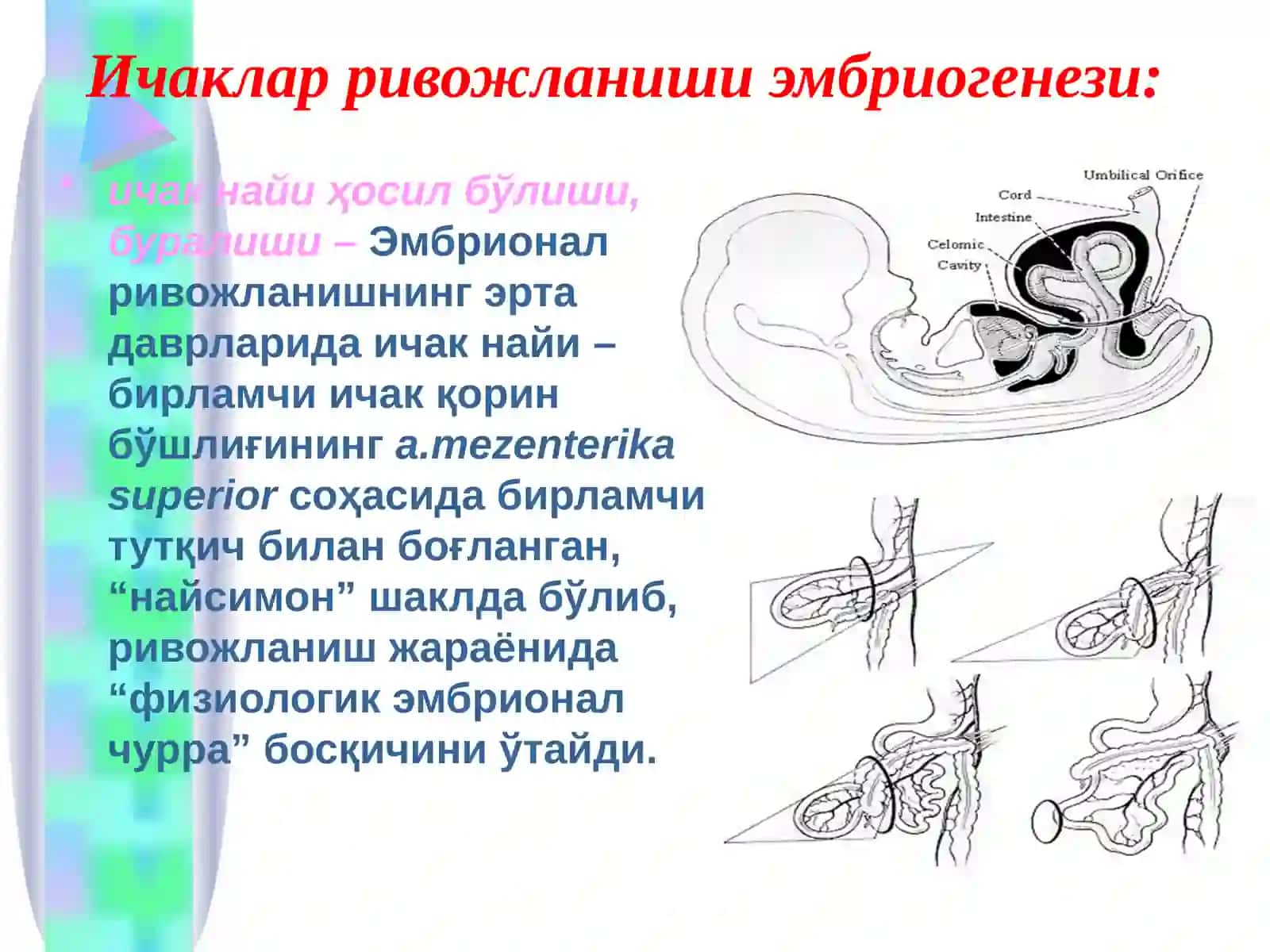 Болаларда туғма ичак тутилишлари 4