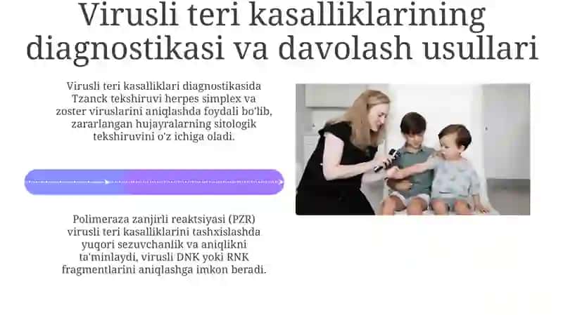 Terining virusli kasalliklari 4