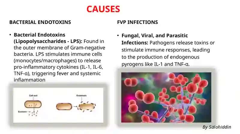 Pyrogen Reactions: Causes, Clinical Image, Diagnostic Approach, and First Aid 4