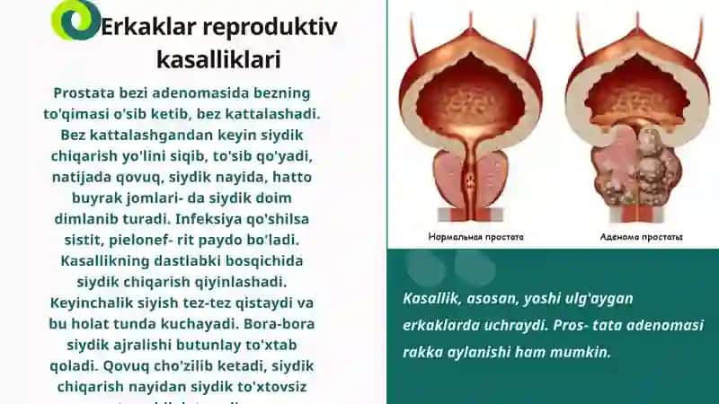 Reprotuktiv a'zolar tizimi kasaliklari 4