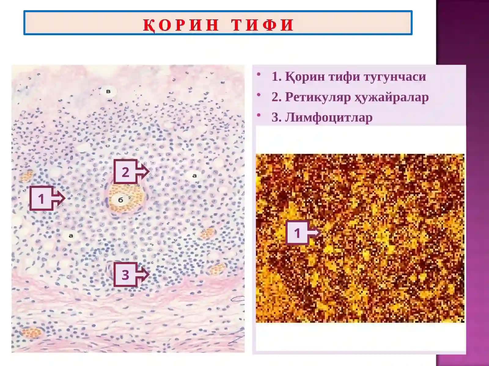 ПАТОЛОГИК АНАТОМИЯ 4
