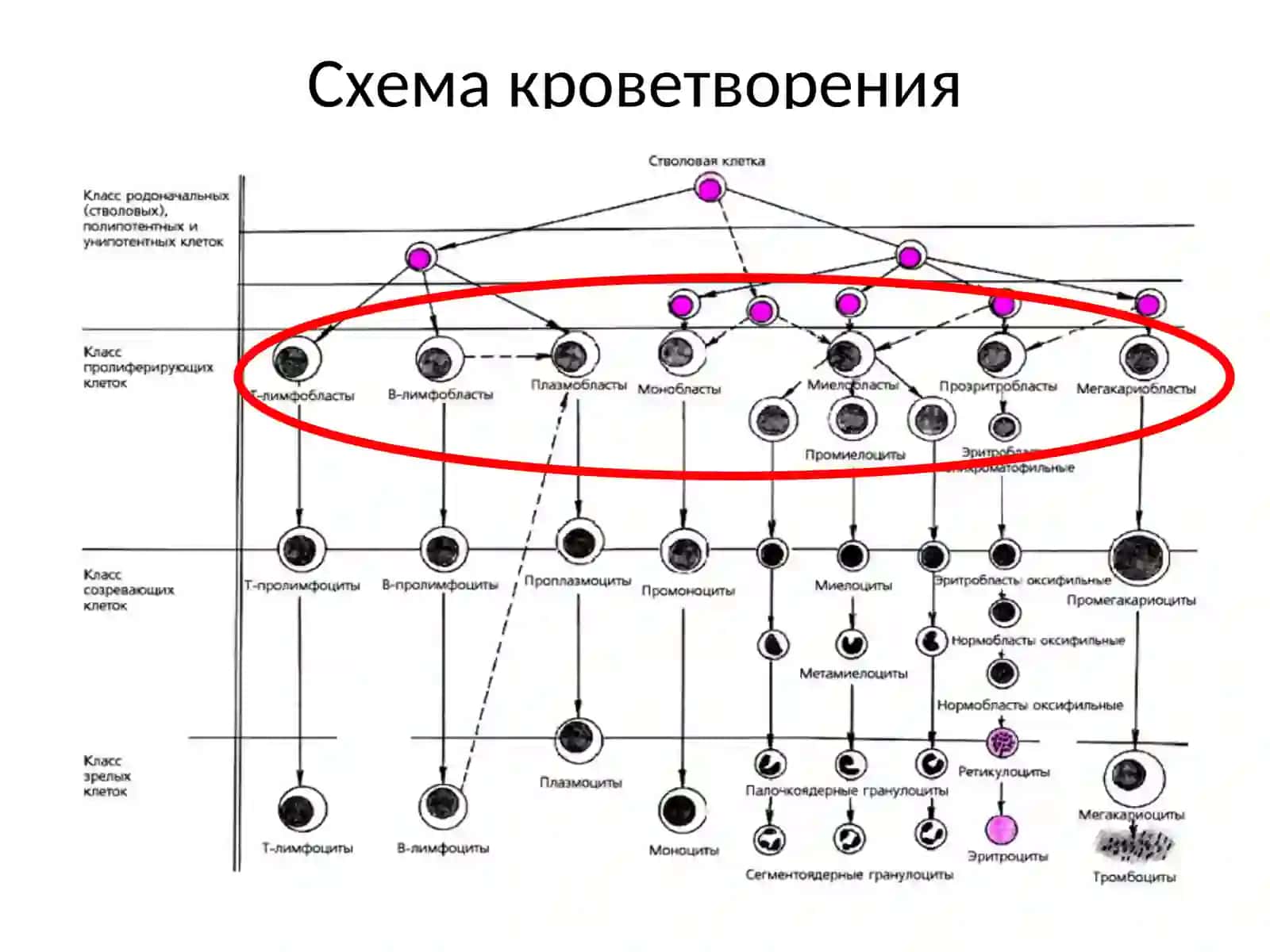 Лейкозы 4