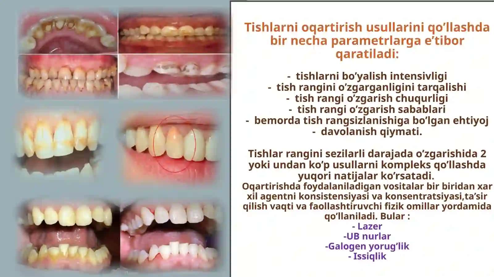 Tishlarni oqartirish usullari 4
