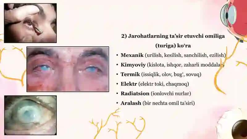 KO‘RUV A’ZOSI JAROHATLARI 4