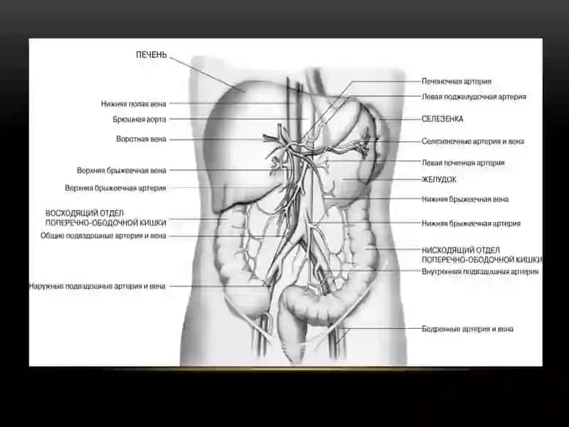 Синдром хронической абдоминальной ишемии 4