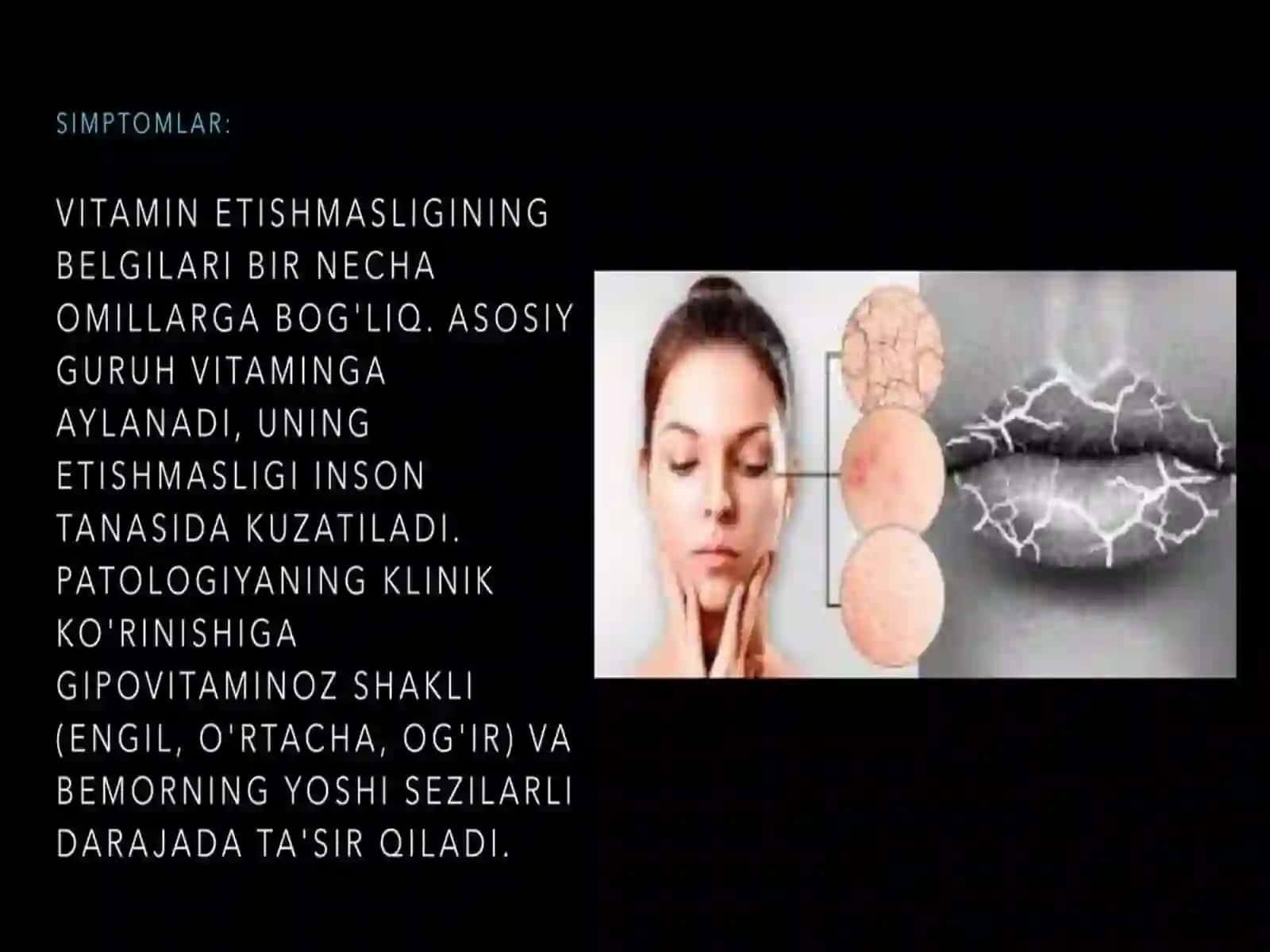 Avitaminoz va gipovitaminoz 4