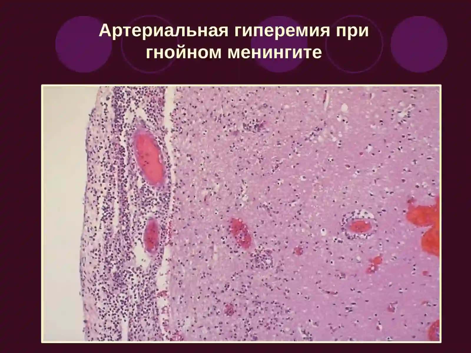 Гемодинамические расстройства 4