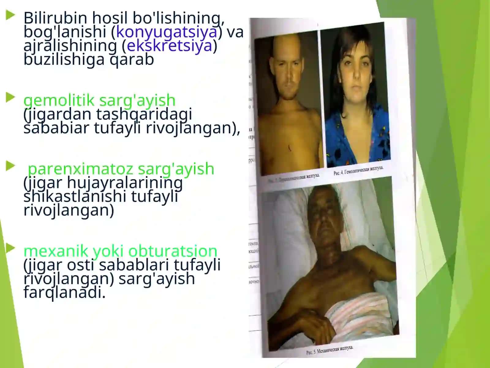 JIGAR VA O'T YO'LLARI SISTEMASI SINDROMLARI 4