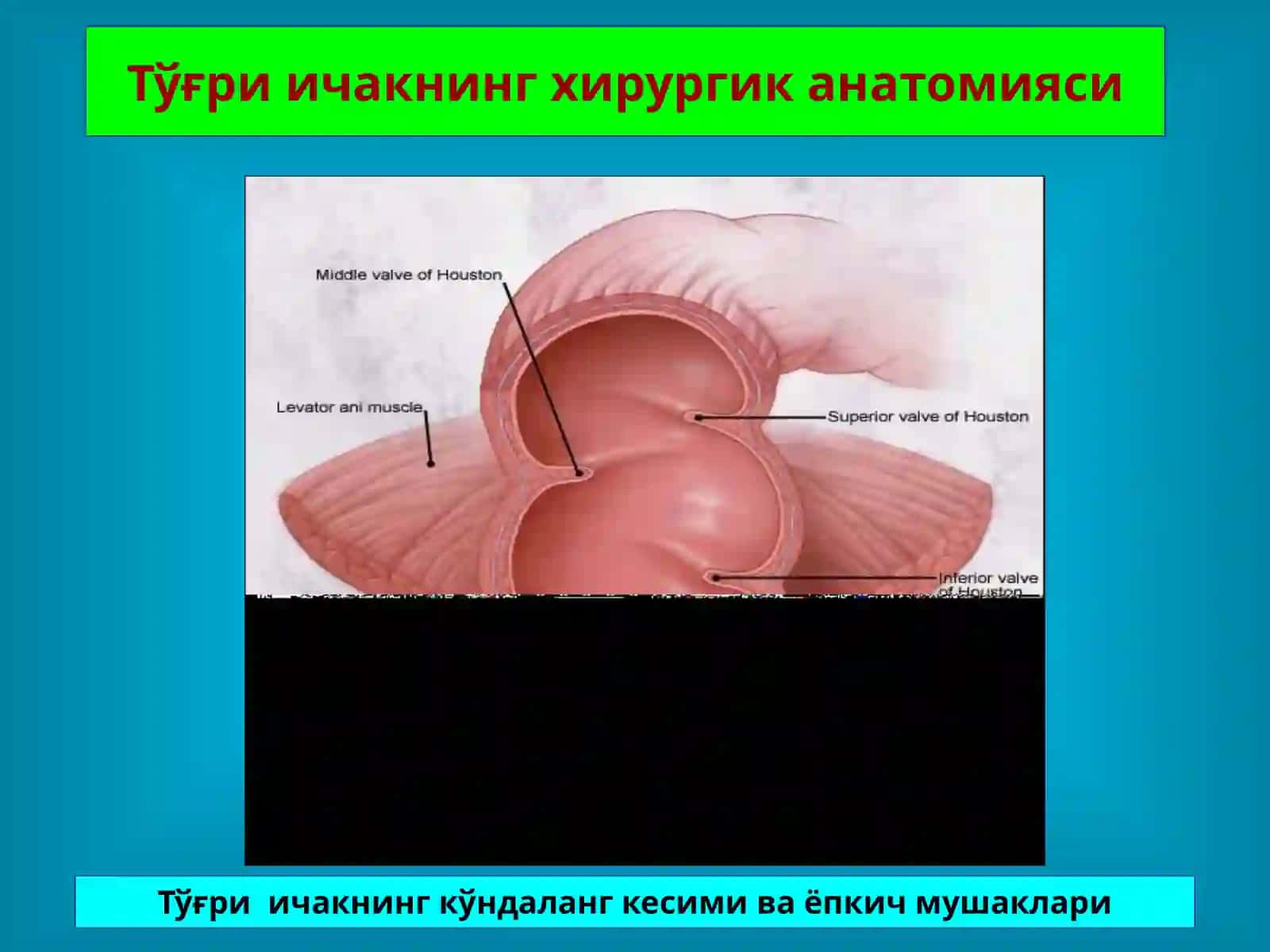 ТЎҒРИ ИЧАК КАСАЛЛИКЛАРИ 4