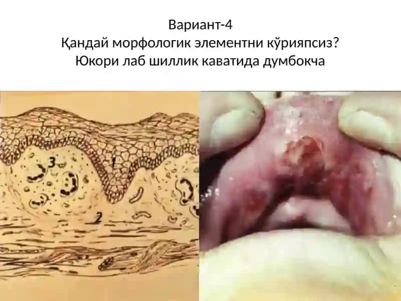 Расмдани маник ўрияпсиз 4