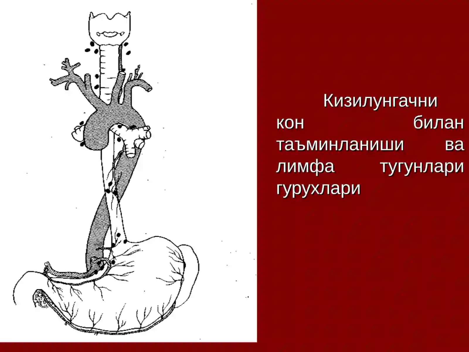 Кизилунгач саратони 4