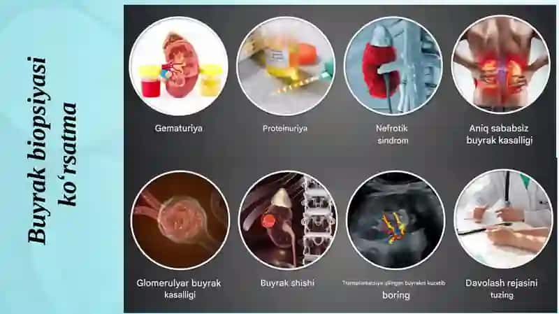 Buyrak biopsiyasi pptx 4