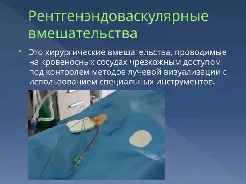 ИНТЕРВЕНЦИОННАЯ РАДИОЛОГИЯ 4