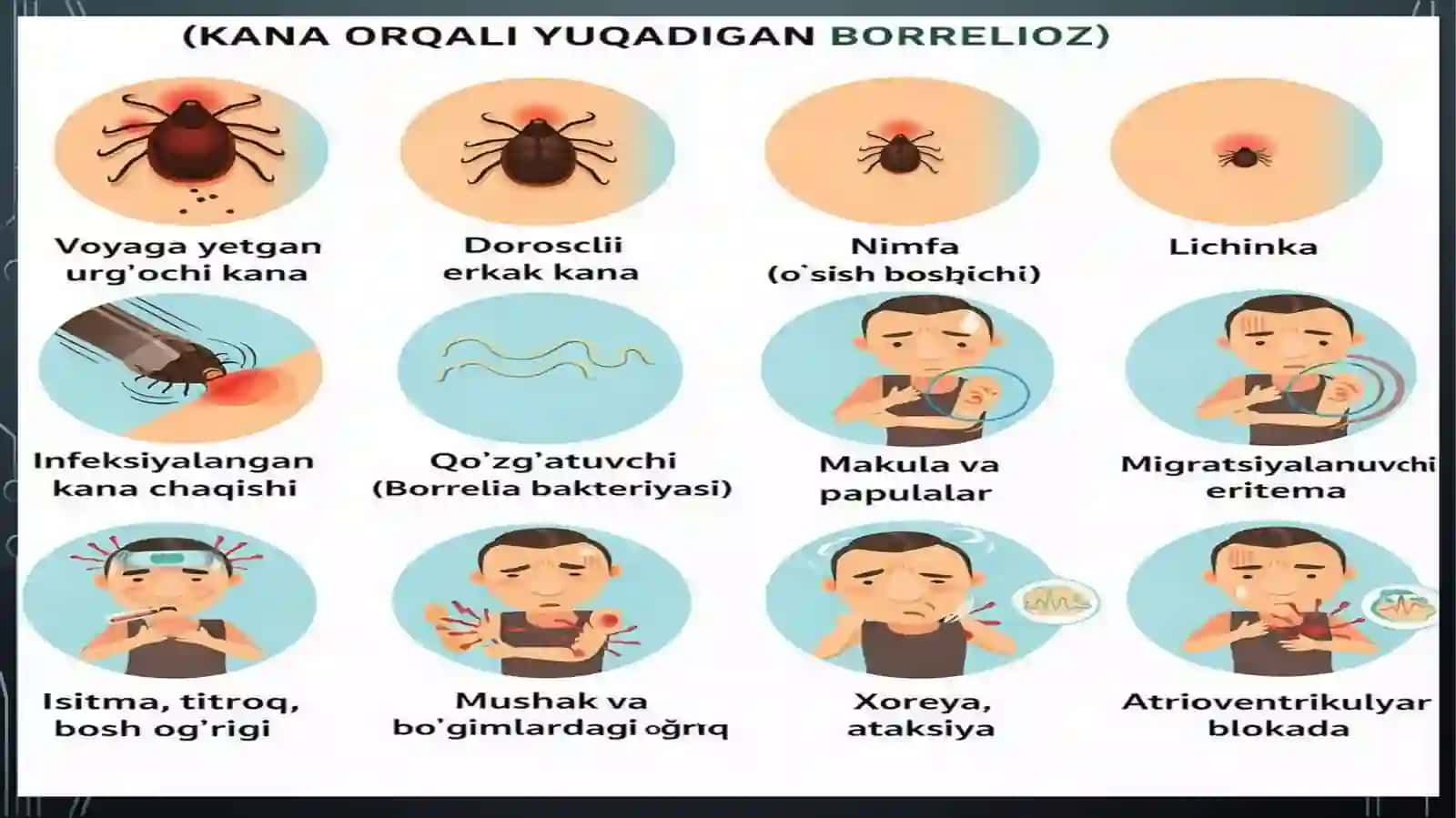 Borrelioz(Layma–kasalligi). Leptospiralar morfologiyasi, strukturasi,tarqalganligi, keltirib chiqaruvchi kasalliklari va laboratoriya tashhisi 4