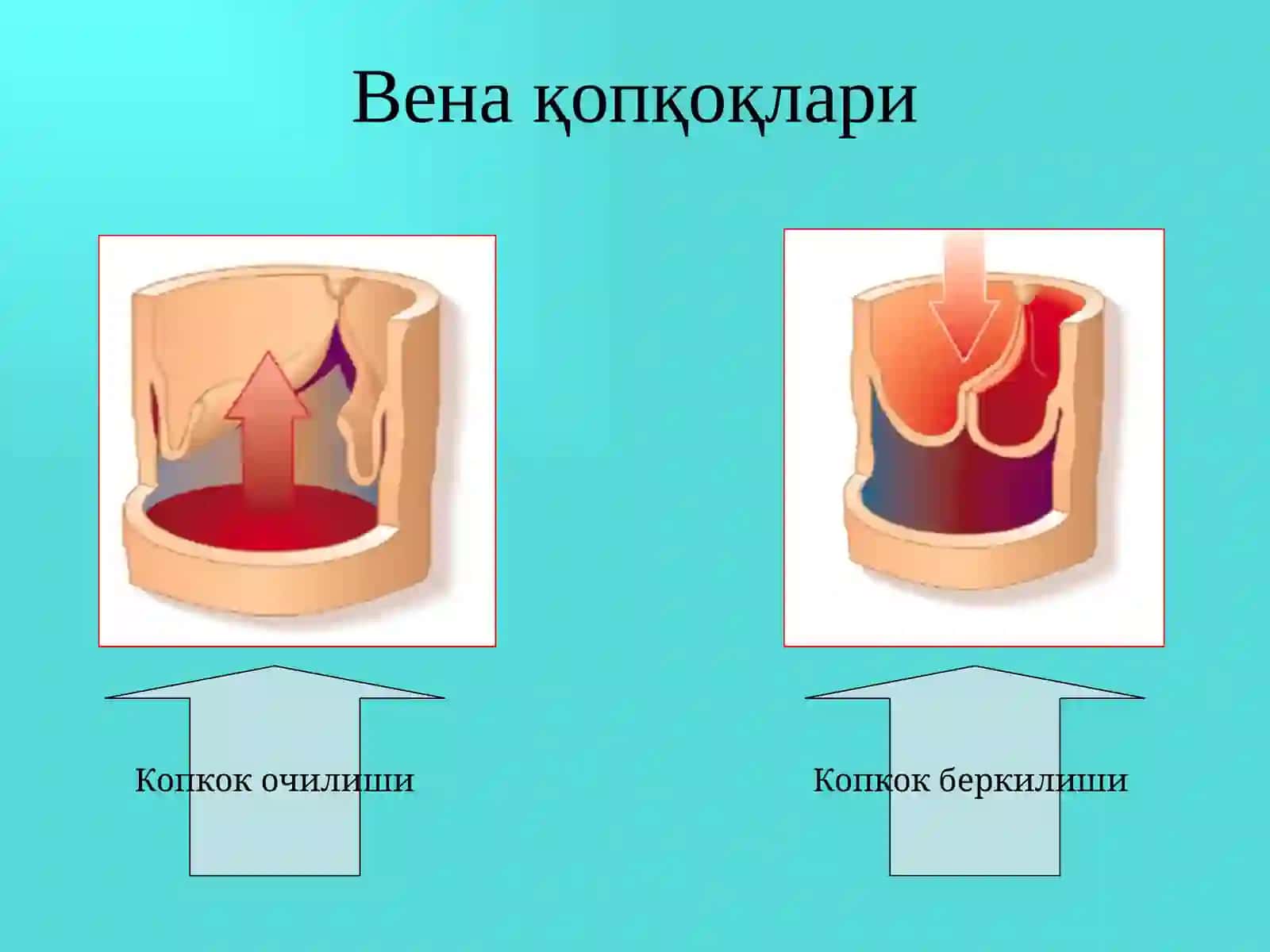 Оёқ веналарининг варикоз касаллиги 4