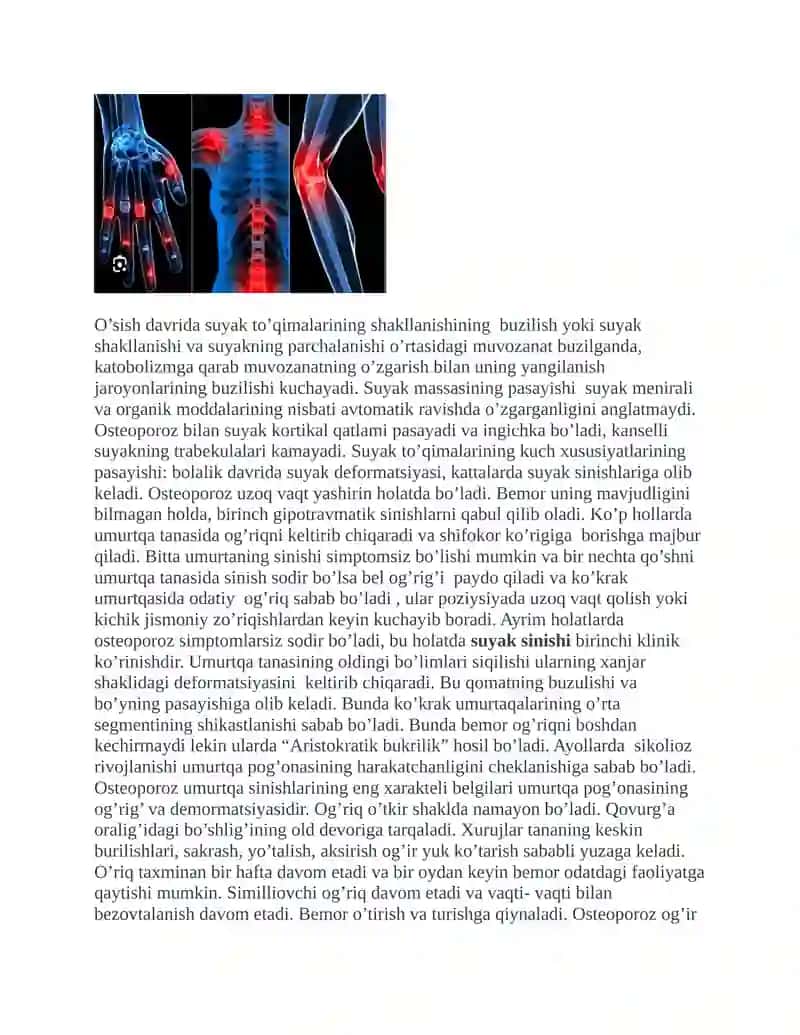 OSTEOPOROZ KELIB CHIQISH SABABLARI, ANIQLASH USULLARI, OLDINI OLISH YO’LLARI VA DAVOLASH CHORALARI 4