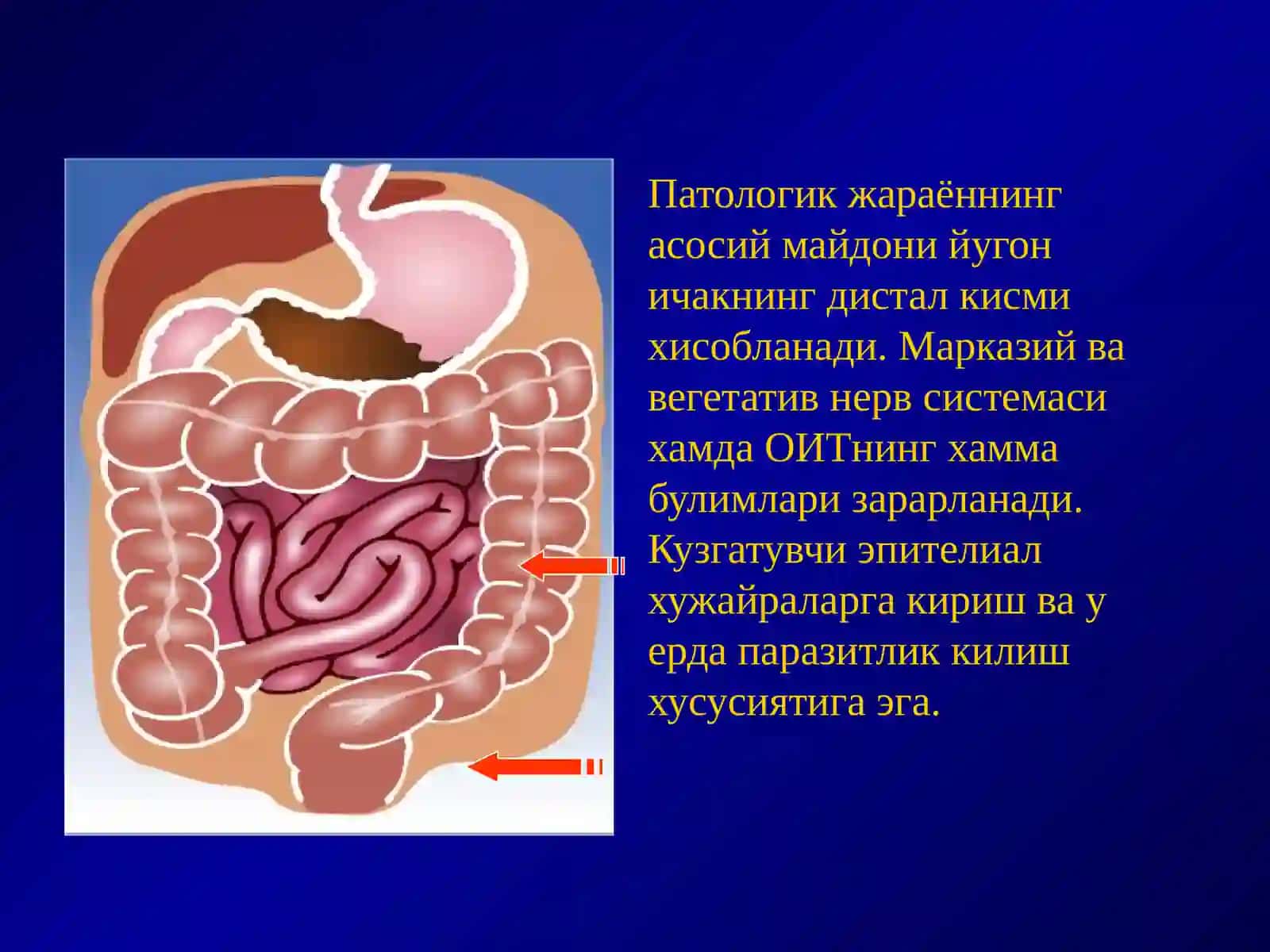 ШИГЕЛЛЕЗЛАР (бактериал дизентерия) 4
