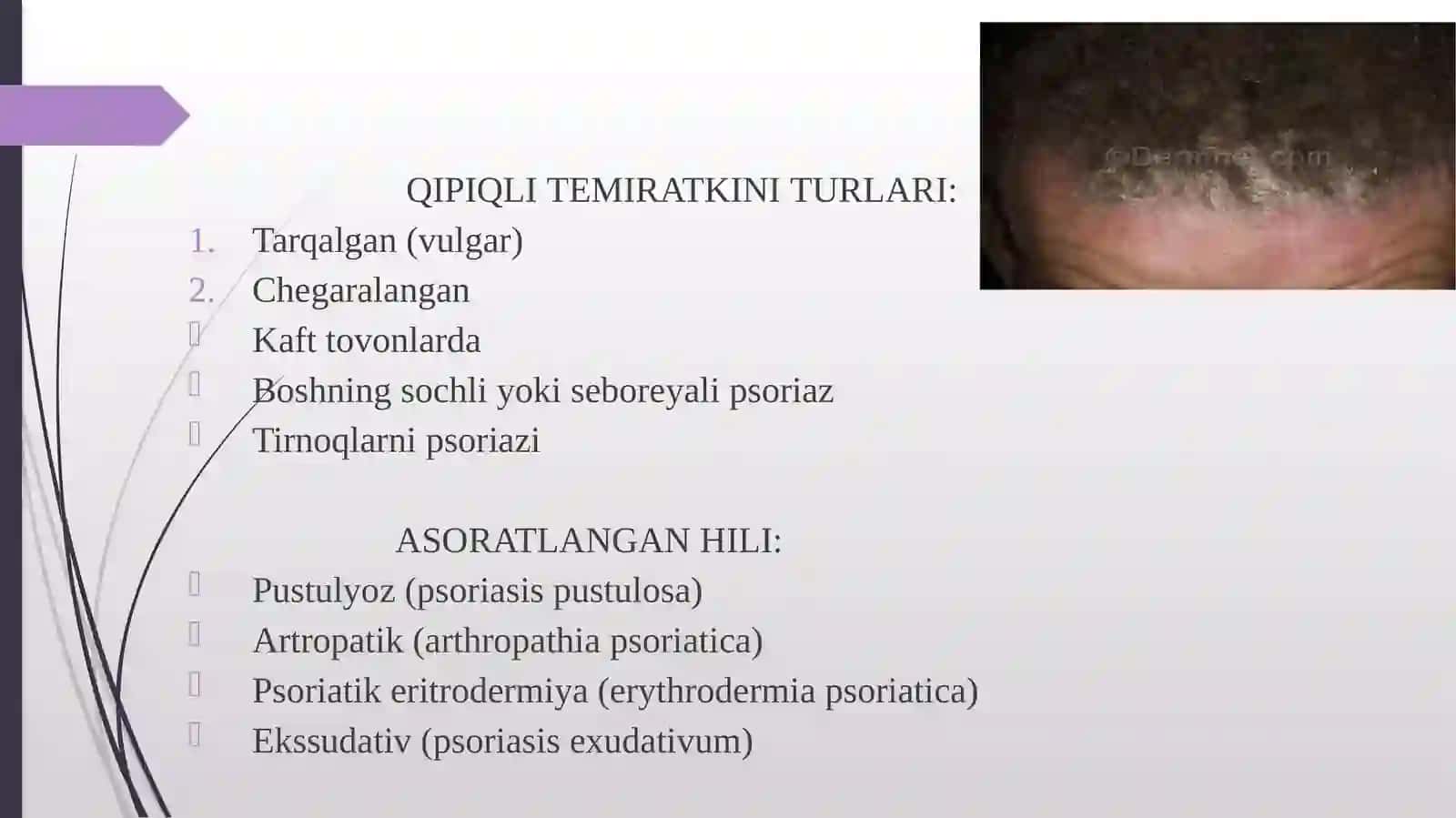 Papulyozdermatozlar ve psoriaz 4