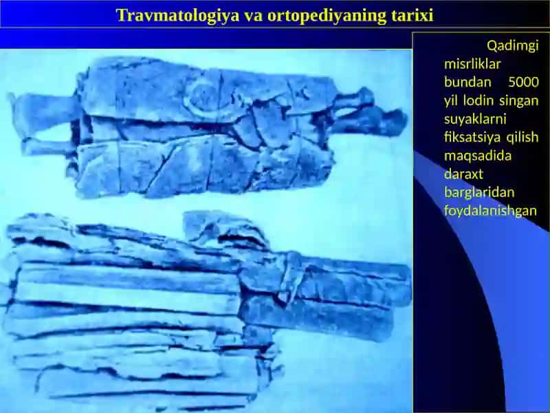 Travmatologiya va Ortopediya 4