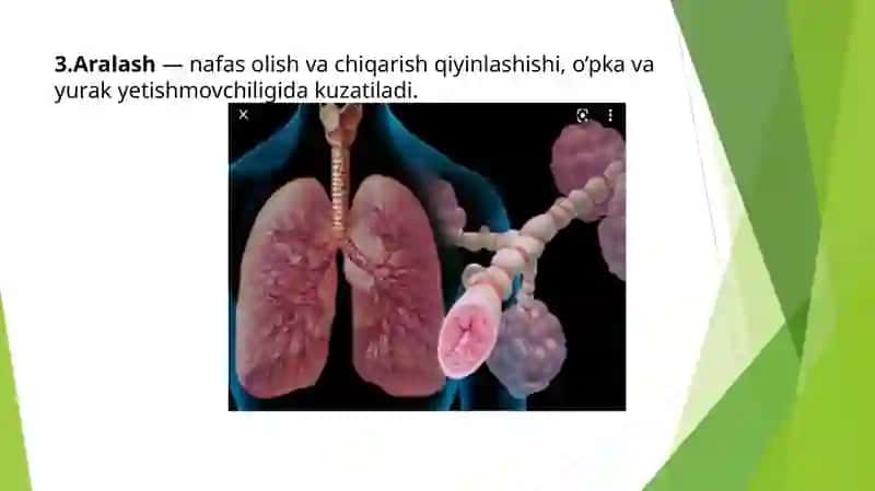 Xansirash: algoritmik yondashuv asosida differensial diagnostikasi 4