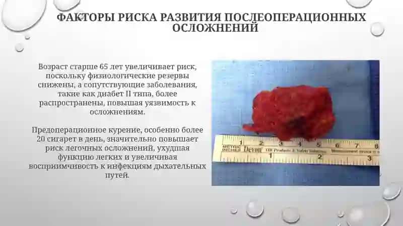 Лечебное дело 2 4