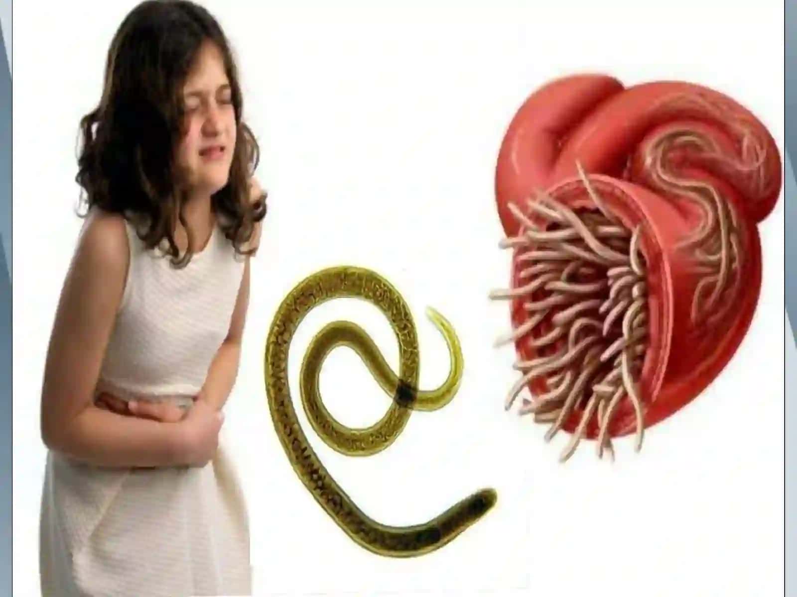 Bolalardagelmintozlar 4
