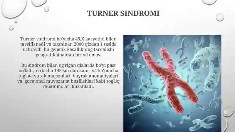Xromosoma kasalliklari 4