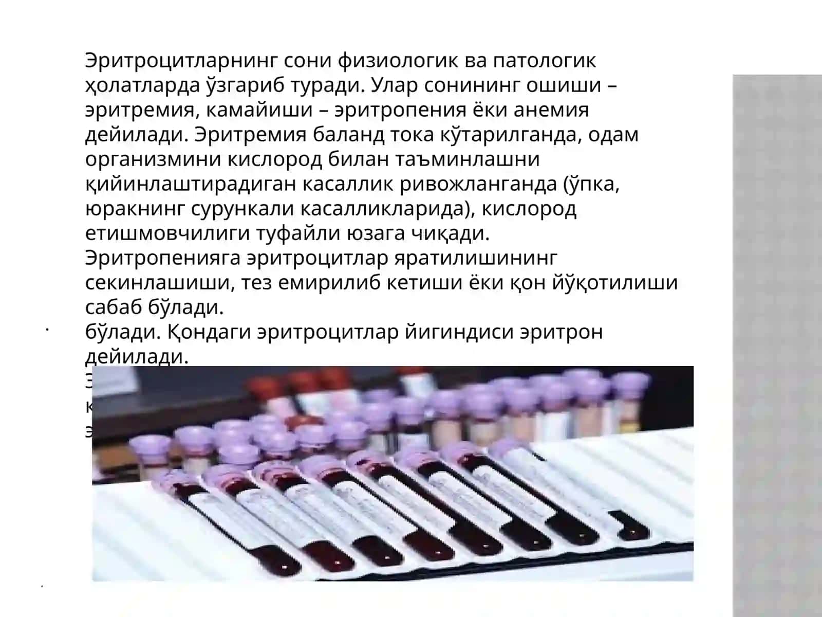GIMOGLABINNING TUZILISHI 4