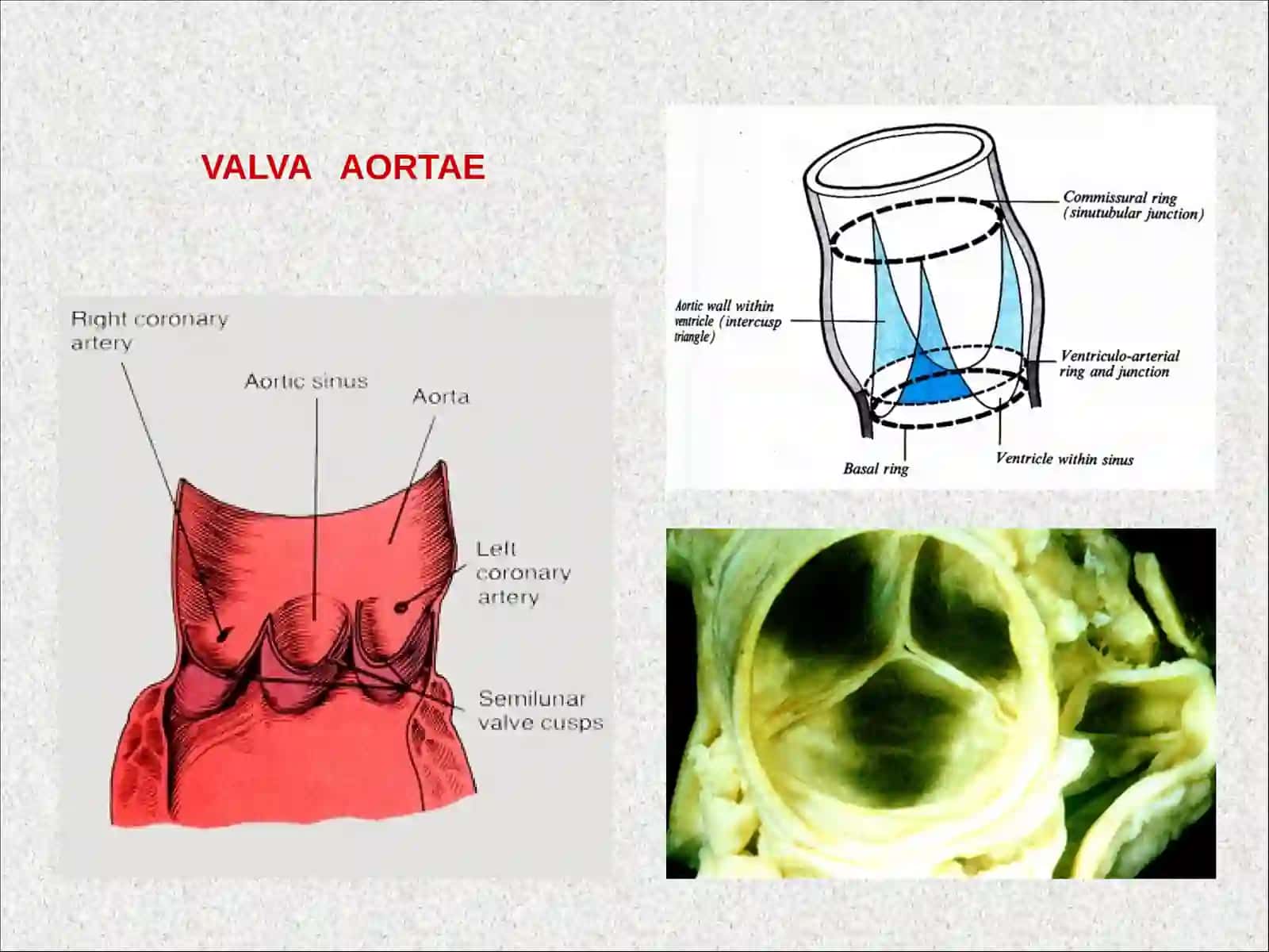 AORTA.TASHQI VA ICHKI UYQU ARTERIYALARI 4