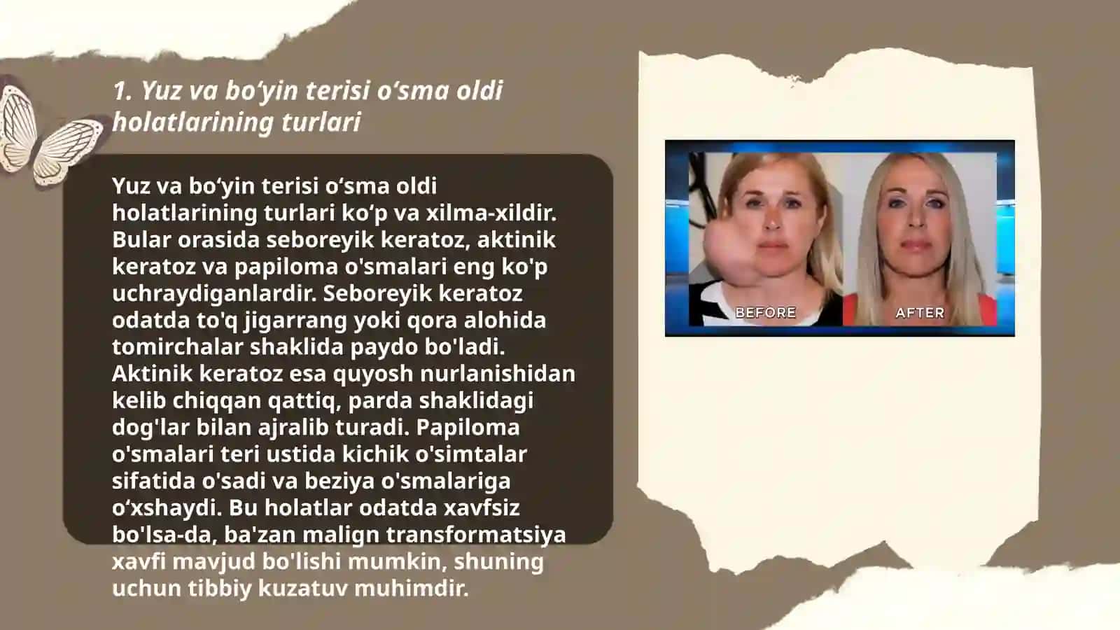 Yuz va boʻyin terisi oʻsma oldi jarayonlari 4