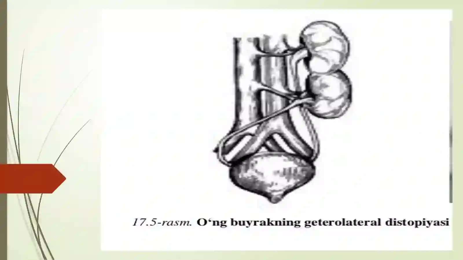 BUYRAKLARNING TUG’MA VA ORTTIRILGAN DISTOPIYASI 4