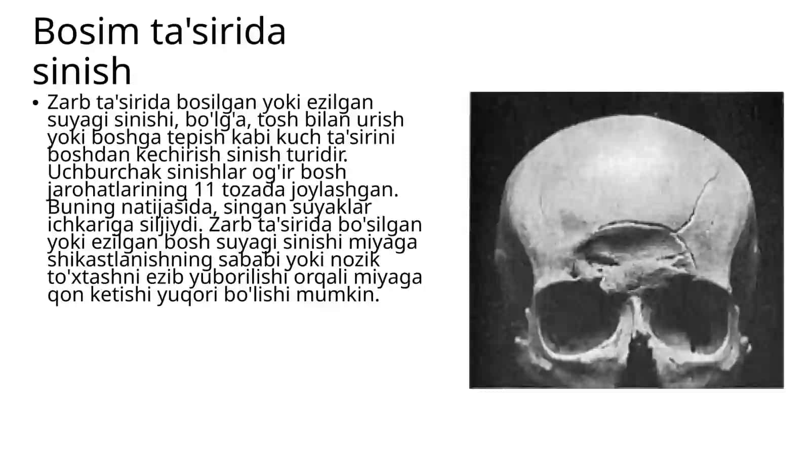Kalla suyaklarining rentgenanatomiyasi 4