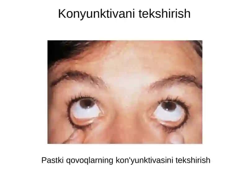 KO'ZYOSH BEZI XAVSIZ O’SMASI 4