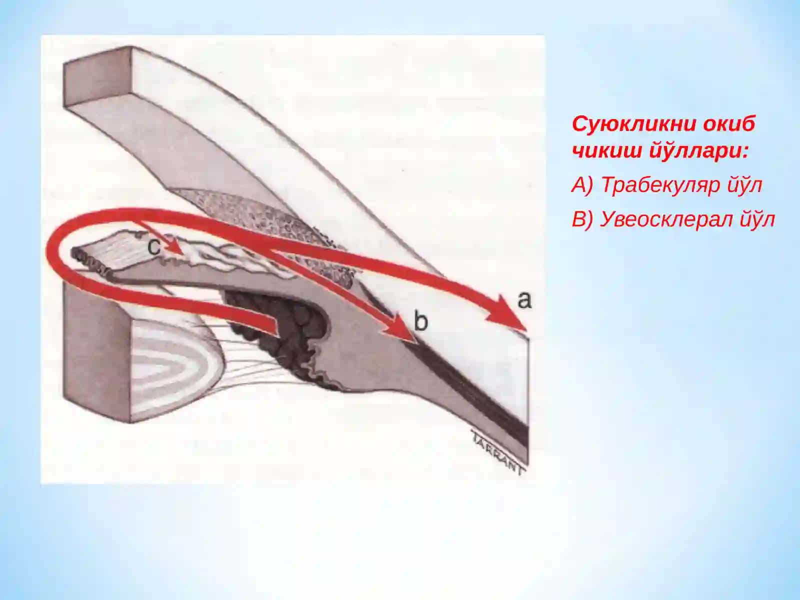 Glaukoma, Глаукома Олдинги камера бурчаги анатомияси 4