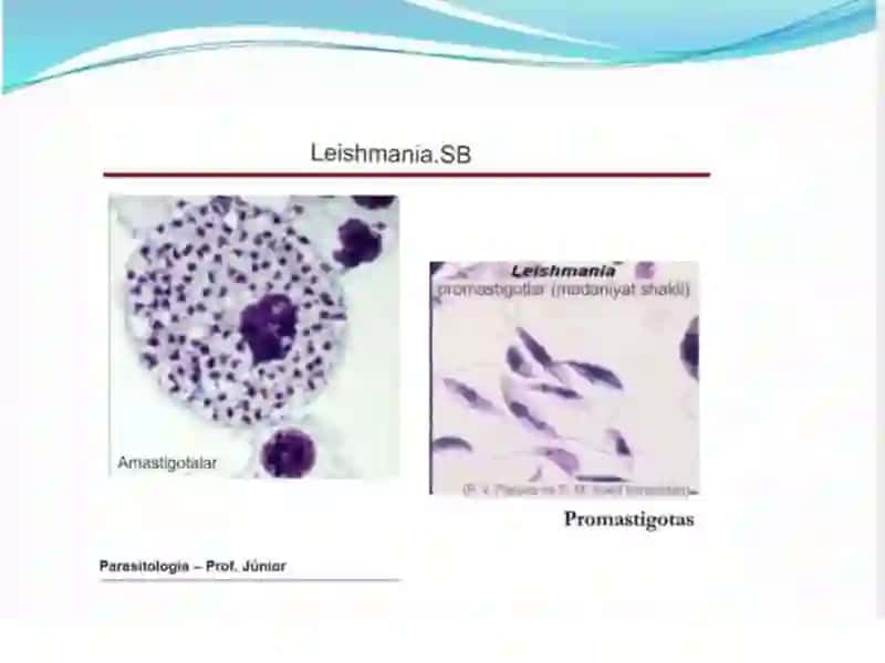 LEYISHMANIOZ 4