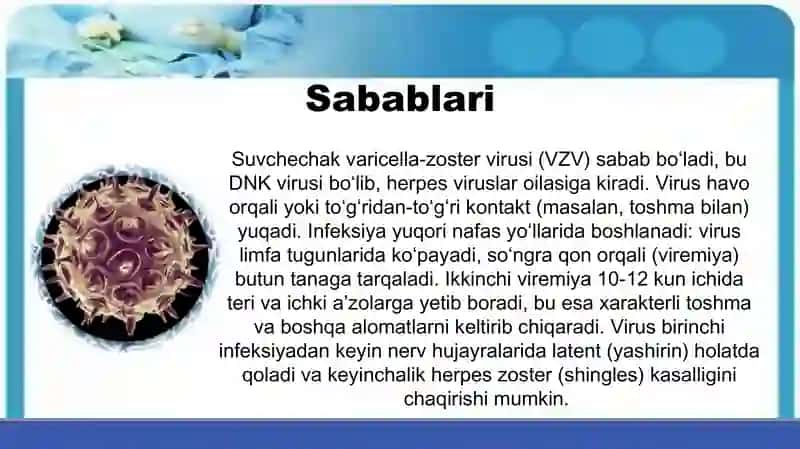 Suvchechak kasalligi 4