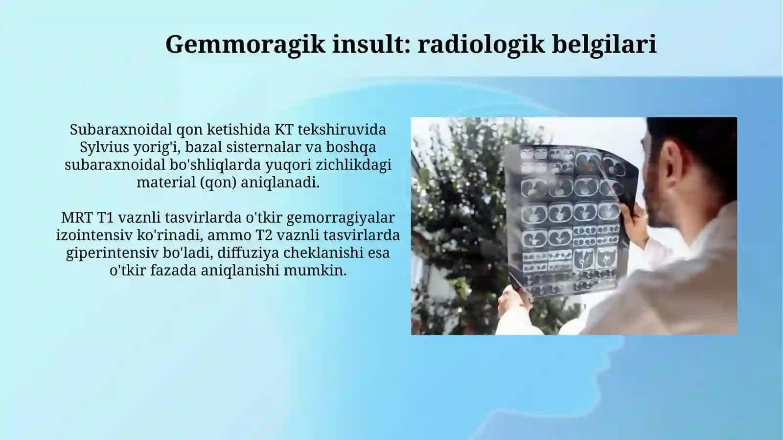 Serebrovaskulyar kasalliklar: radiologiyasi 4