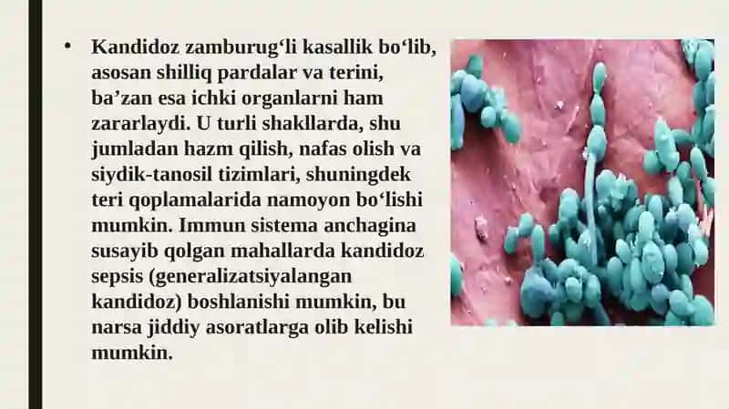 Zamburugʻ infeksiyalari(Kandidoz va aspirgellez) 4